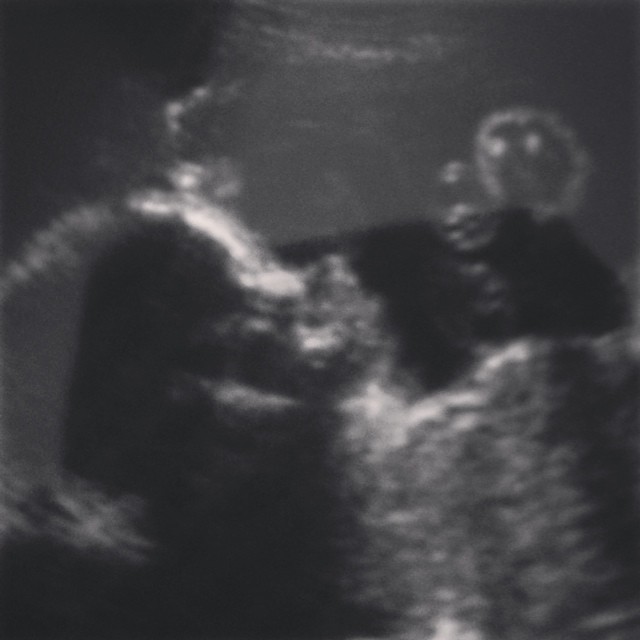 already crowding your newsfeed with pictures of our little man...and just wait til I pop him out! #apologiesinadvance